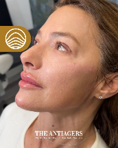 Signature Antigravity Lift™